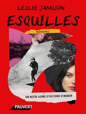 cover image of Esquilles